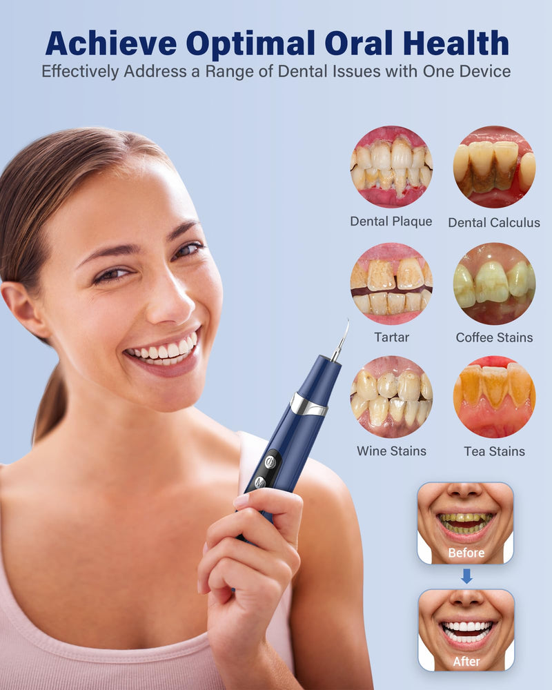 Plaque Remover for Teeth - Tartar Remover for Teeth with LED Light & 5 Modes, Rechargeable Hard Plaque Remover with 2 Replaceable Heads, Ultrasonic Teeth Cleaner Kit for Home Use Blue - BeesActive Australia