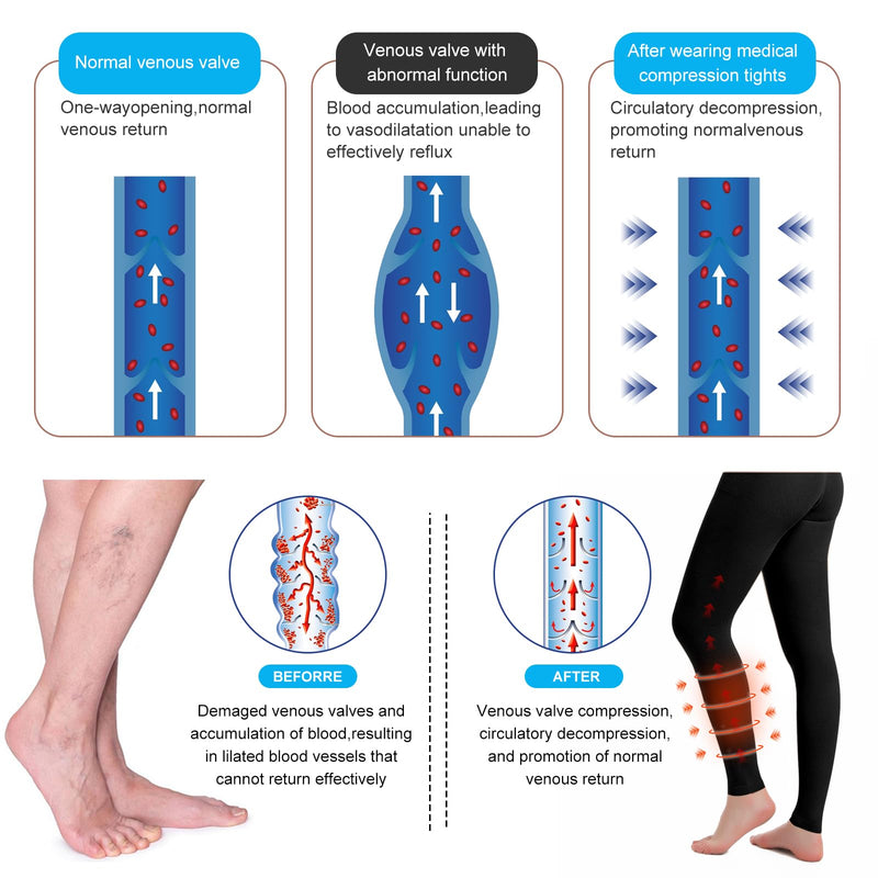 2 Pairs Medical Compression Pantyhose for Women & Men, 20-30mmHg Graduated Support Tights, Opaque Footless High Waist Large Black