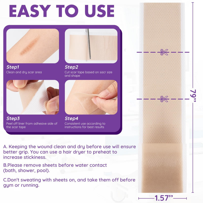 Silicone Scar Sheets, Silicone Scar Tape, Reusable Professional Scar Silicone Strips, Soft Silicone Scar Sheets for Surgical Scars,Keloid,Acne Scars,Burn Scar,C-Section (5M) 5M - BeesActive Australia