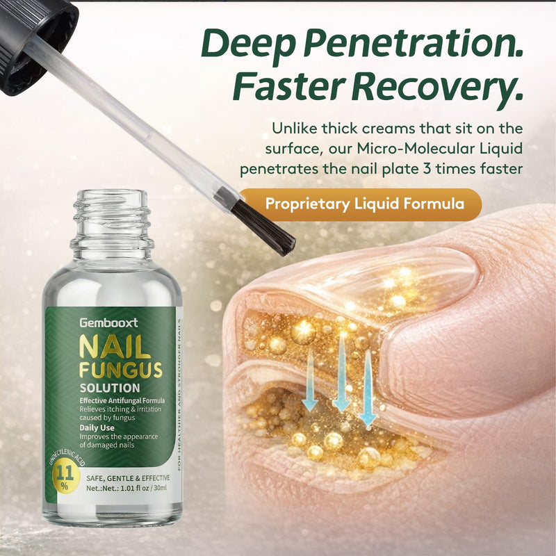 Toenail Fungus Treatment Extra Strength with Undecylenic Acid & Tea Tree Oil, Nail Fungus Treatment for Toenail & Fingernails, Antifungal Nail Repair for Damaged Nails & Thick Toenails-30ml