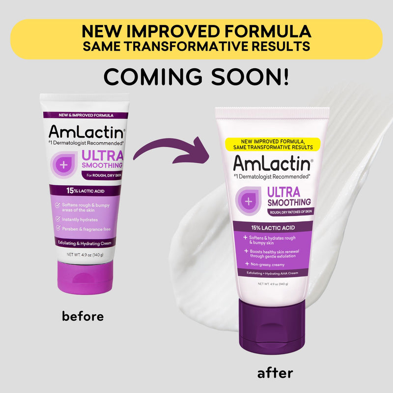 AmLactin Ultra Smoothing - Therapeutic Hand Cream for Dry Cracked Hands - No-Scrub Exfoliator and Moisturizer with 15% Lactic Acid AHA, 4.9 oz (Packaging May Vary)