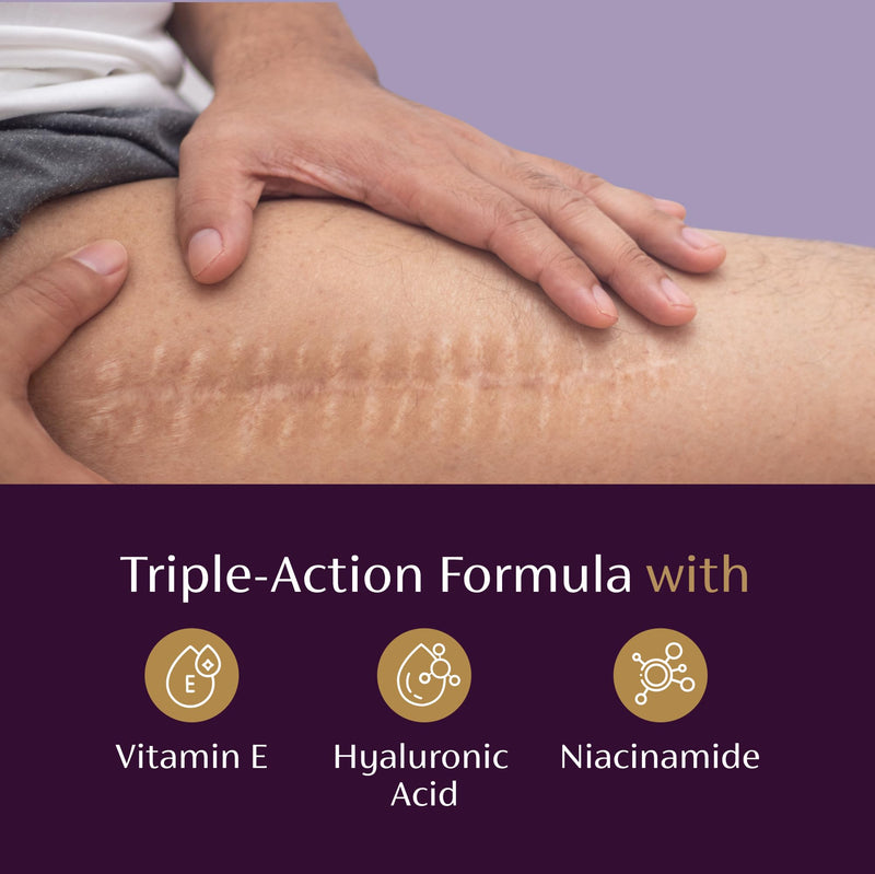 Mederma Scar Serum – Triple-Action Formula with Vitamin E, Hyaluronic Acid & Niacinamide – Clinically Shown to Reduce Old Scars, 1 Fl. Oz. - BeesActive Australia