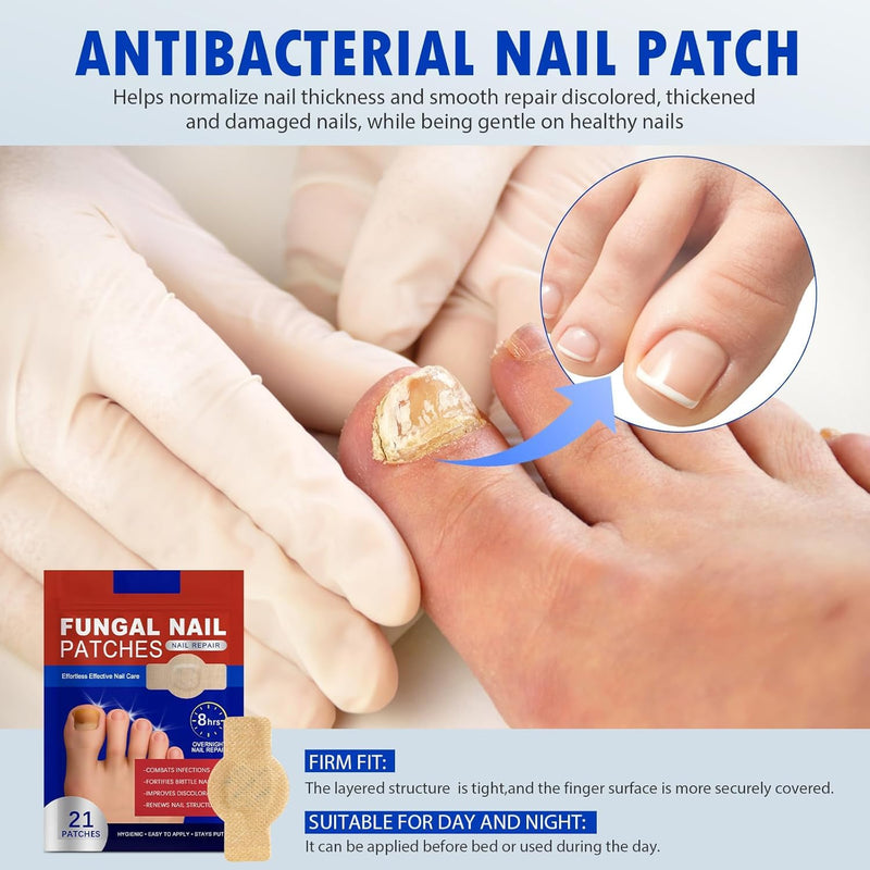 Nail Patches 21 PCS Toenail Treatment Extra Strength 8-Hour Overnight Nail Fast Acting Repair Effortless Hydrogel Nail Care and Repair for Damaged Nails Overnight Renewal for Men and Women 0 Ounce (Pack of 21)
