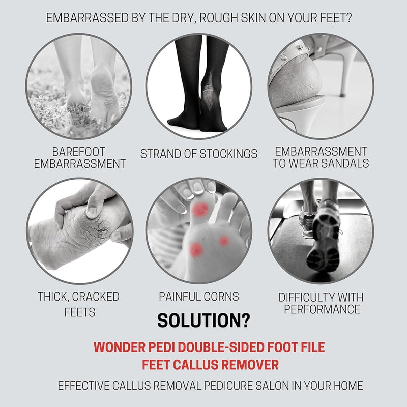 Made in Germany Ceramic Stone and Stainless Steel Foot File, Double Sided Callus Remover, Feet Scrubber, Professional Pedicure Foot Care Tool Rasp, Long Lasting Foot Buffer, Heel Scraper, Wonder Pedi Classic - BeesActive Australia