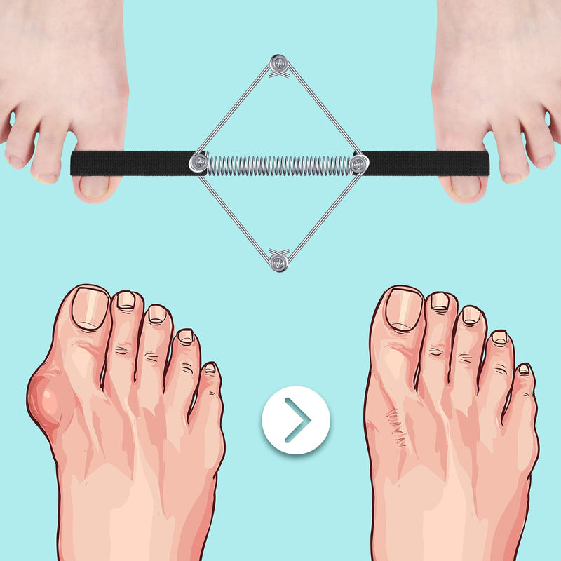 Pilates Toe Stretcher Bunion, Hallux Valgus Big Toe Strap Spacer Tension Bunion Exercise Band Stretchy Alignment Splint Restores Pain Relief for Women Men (Pack of 2) One Size (Pack of 2)