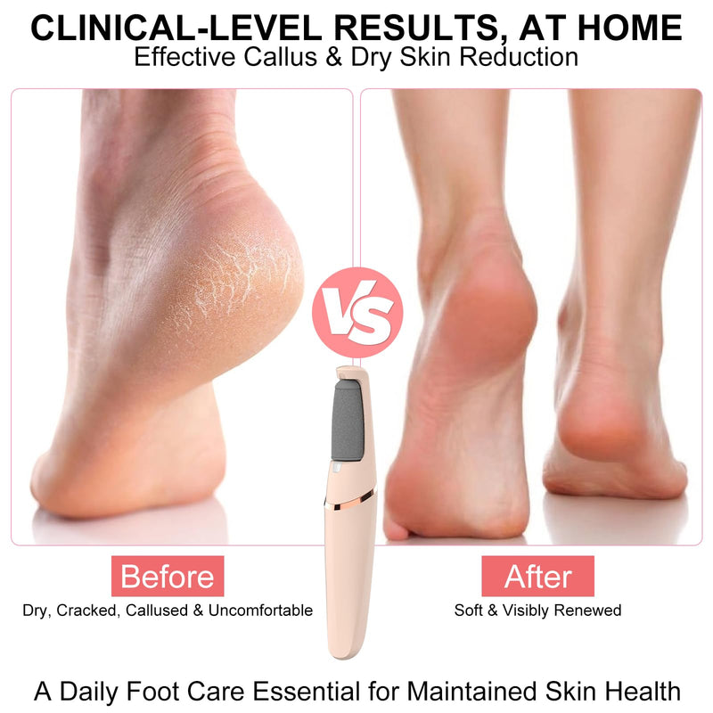 Electric Foot File, Callus Remover for Feet,Rechargeable Foot Pedicure Tool for Dry &Dead Cracked Skin,Professional Cordless Hard Skin Removal with 2 Durable Heads - BeesActive Australia