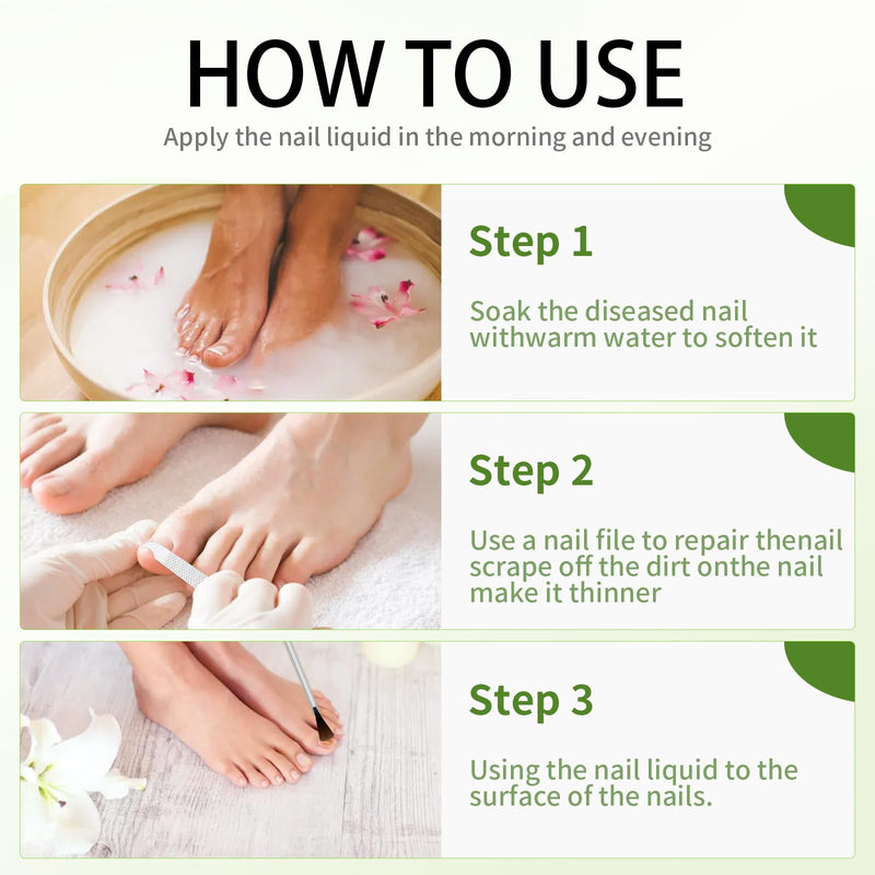 Toenail Fungus Treatment Extra Strength: 7 Pure Natural Plant Extracts，Toe & Fingernail Fungus Renewal - Nail Fungus Treatment Kit with Brush & File - For Ingrown Nails & Discoloration