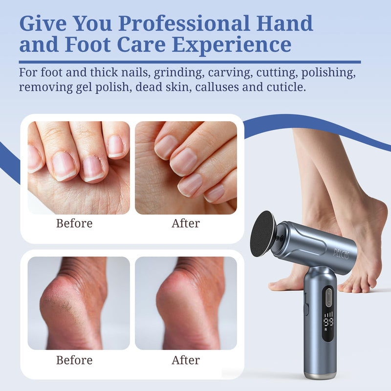 PELCAS Electric Foot Callus Remover with LED Screen, Upgraded Electric Foot File, 2 in 1 Manicure & Pedicure Kit for Women & Men, Cordless Feet Filer for Foot Callus, Thick Nails, Finger Nails Grey - BeesActive Australia