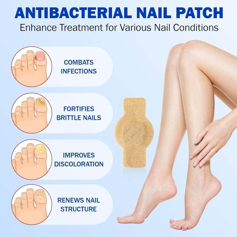 Fungal Nail Patches Extra Strength : 21pcs Overnight Treatment for Damaged & Discolored Nails, Gentle Strengthening Solution, Skin-Safe & Travel-Friendly,Easy to Apply (Large 42) 1.71 Ounce (Pack of 42)