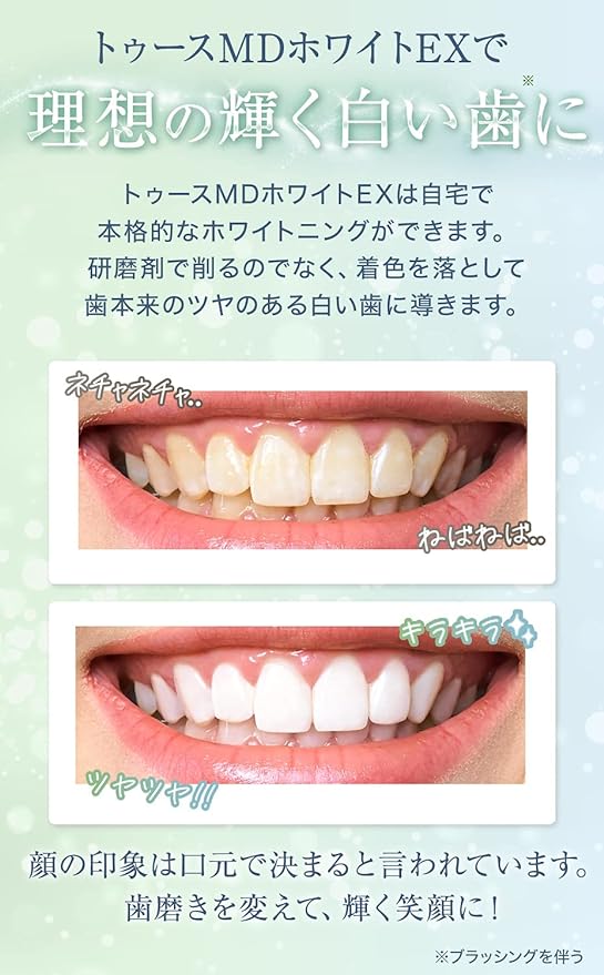 Quasi Drug Whitening Toothpaste Medicated Toothpaste MD White EX Dental Toothpaste Gel for Bad Breath Prevention - BeesActive Australia