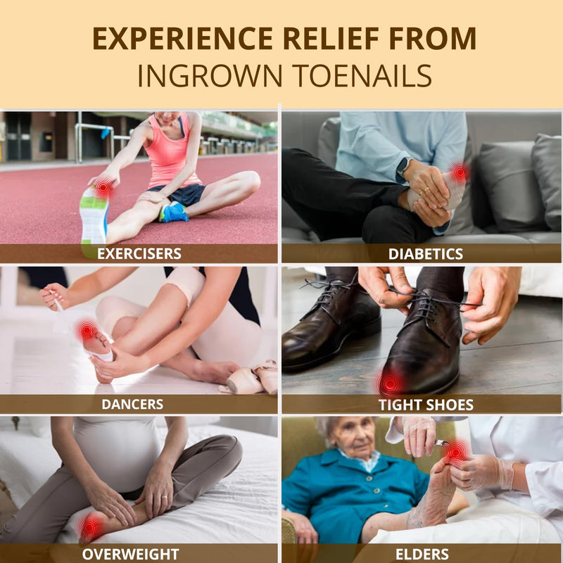 Ingrown Toenail Relief: Ingrown Toenail Drops - Ingrown Toenail Removal Kit - Toe Ingrown Nail - In Grown Toenail - Ingrown Toenail Tool - Easy Effective Solution for Ingrown Toenails - 2 Pack 1 Fl Oz (Pack of 2)