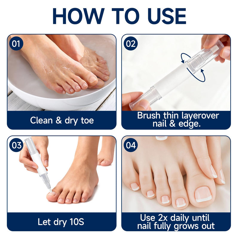 Nail Repair Pen with Lauric Acid and Glycerin—Strengthens brittle nails, providing cooling relief for toenails and fingernails - BeesActive Australia
