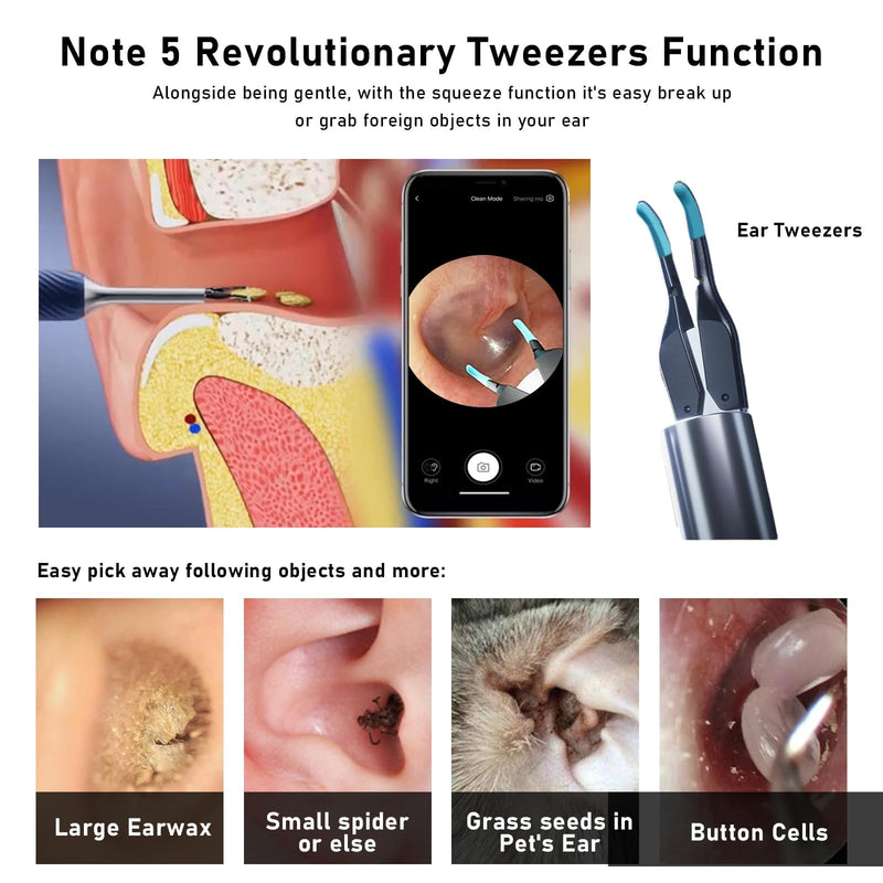 Note5 Ear Wax Removal Kit with Camera,10MP Ear Cleaner Camera Otoscope with Light,Real-time Remote Video with Ear Pick & Tweezers,12 Pcs Ear Scoops for Whole Family Update Ear Wax Tweezers - BeesActive Australia
