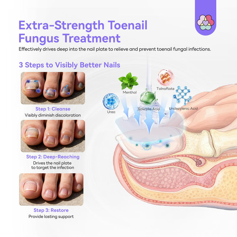 SAVILAND Toenail Fungus Treatment Extra Strength: 2X Extreme Nail Repair for Discolored and Damaged Nails Toenail Softener Yellow Toenail Foot Toe Thick Nail Fungus Treatments Solution 2 fl oz 1 Fl Oz (Pack of 2)