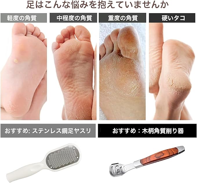 Tribetter Exfoliating Heel File Cuticle Care Set, Fish Eye Cutter, Foot Care, Foot File, Washable for Wet and Dry Feet (Includes 10 Replacement Blades) (White) - BeesActive Australia