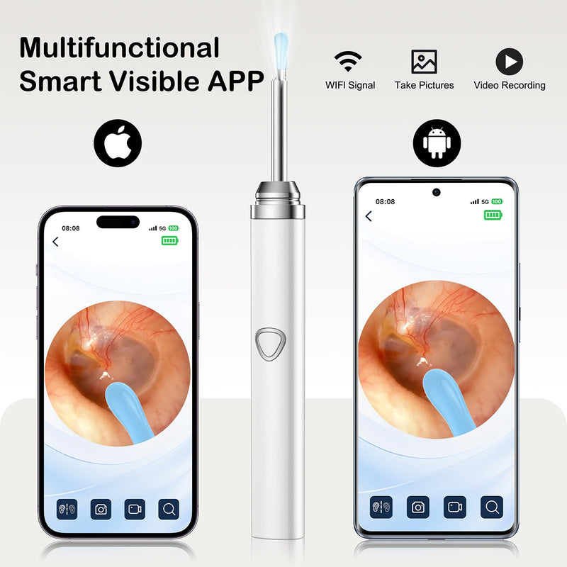 Ear Wax Removal Tool Camera，Wireless Ear Cleaner with Camera 1080P, Earwax Removal Kit with 6 LED Light 5 Replacement Ear Spoon, Ear Camera for iOS & Android (White) White - BeesActive Australia