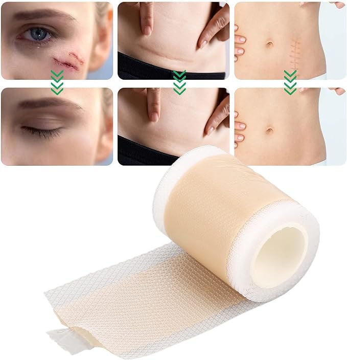 Silicone Scar Sheet, Reusable Silicone Scar Strip Roll Scar Sheet Breathable Scar Removal Sheet Scar Strip Silicone Scar Tape Roll Scar Silicone Tape Cover Up Silicone Gel Cream Patch Bandage - BeesActive Australia