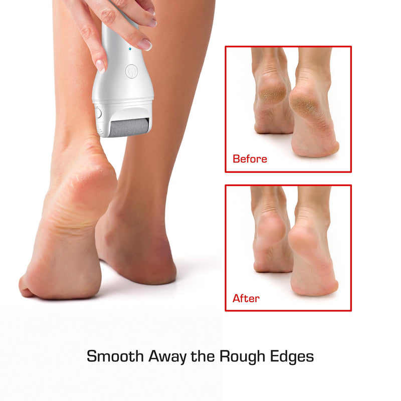 Red by Kiss Cordless Electric Foot File Callus Remover, 3 Roller Heads & 2 Speed Setting, Long and Curved Roller Head Stone, Wet & Dry Dual Purpose, Up to 2 hr Runtime, Easy & Portable - BeesActive Australia