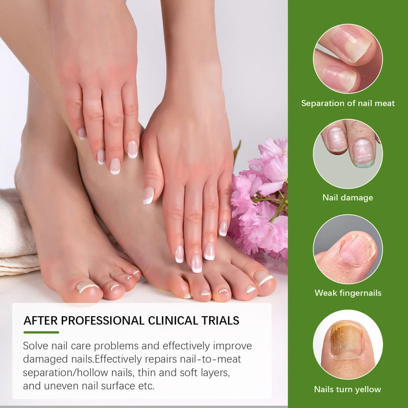Toenail Fungus Treatment Extra Strength: 7 Pure Natural Plant Extracts，Toe & Fingernail Fungus Renewal - Nail Fungus Treatment Kit with Brush & File - For Ingrown Nails & Discoloration - BeesActive Australia