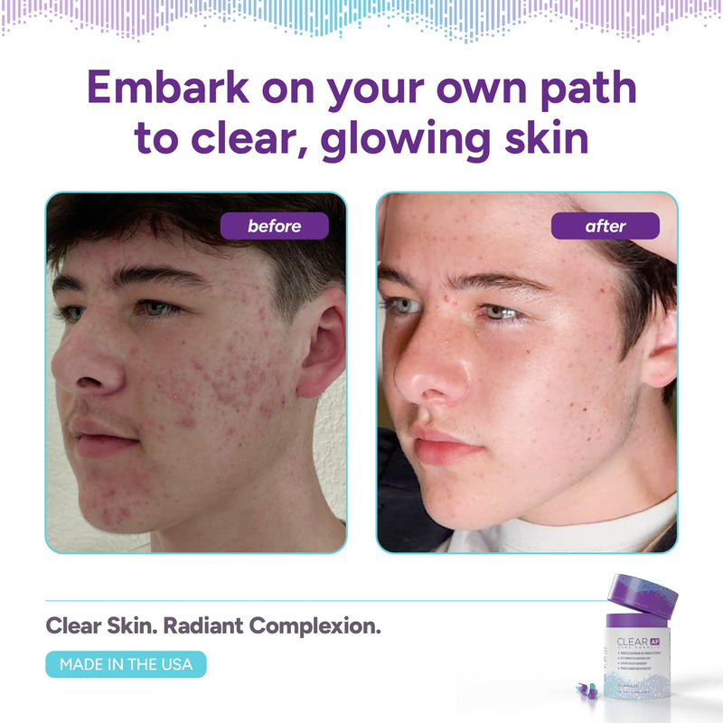 Clear Skin Supplement | Skin Barrier Hydration & Clear Complexion Support with Vegan Ceramides, Zinc, Vitamin D3, B6, Riboflavin & Thiamine | Vegan Capsules | 30-Day Supply