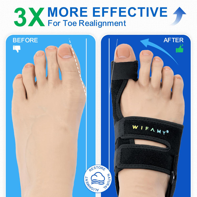 Wifamy Bunion Corrector For Women Big Toe: Soft Gel Toe Separators For Women - Adjustable Straps & Breathable Design - Day/Night Pain Relief For High Heels & Flats
