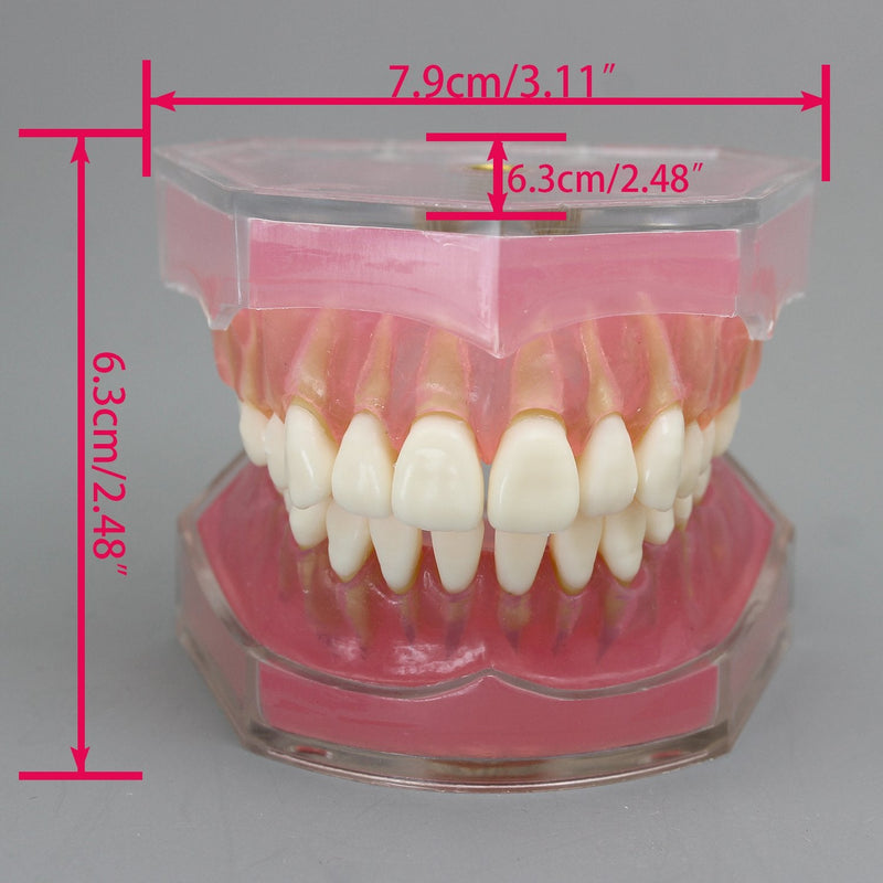 Dental Implant Teeth Model with Removable Teeth for Dental Professionals and Students - BeesActive Australia