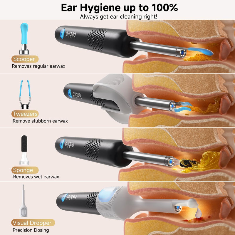 BEBIRD R1 Ultra Ear Wax Removal, Ear Cleaner with Camera Ear Scope, Wax Remove Ear Pick with Ear Otoscope Tweezers, Visual Dropper Cleaning Kit, Ear/Nose/Throat Examination Tool for Family Black - BeesActive Australia