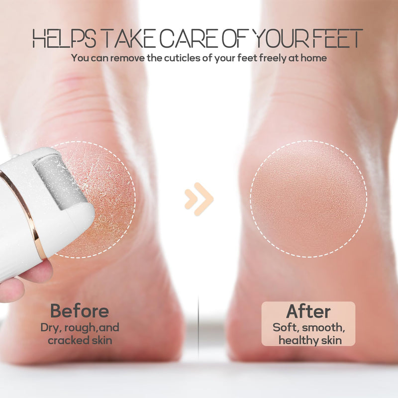 Electric Foot File and Callus Remover, Rechargeable Pedicure Device with Multiple Heads for Dry Rough Feet Care, Home Use Foot Grinder Tool - BeesActive Australia
