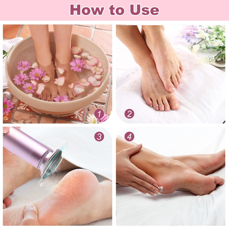 Electric Foot Callus Remover – Foot Callus Remover for Feet with 60 Sandpaper Discs, Adjustable Speed Pedicure Tools for Dead Skin, Professional Electric Feet Callus Remover for Home Use - BeesActive Australia