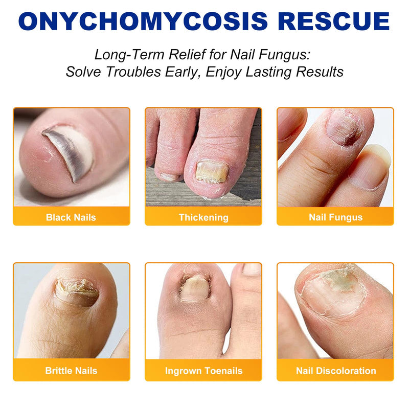 32 PCS Fungal Nail Patches for Broken Damaged Split Nails,Toenail Treatment Extra Strength,Nail Repair for Damaged Nails, Nails Care Supplies, Restore Discoloration and Thickness (2 Pack) 32 Count (Pack of 1)