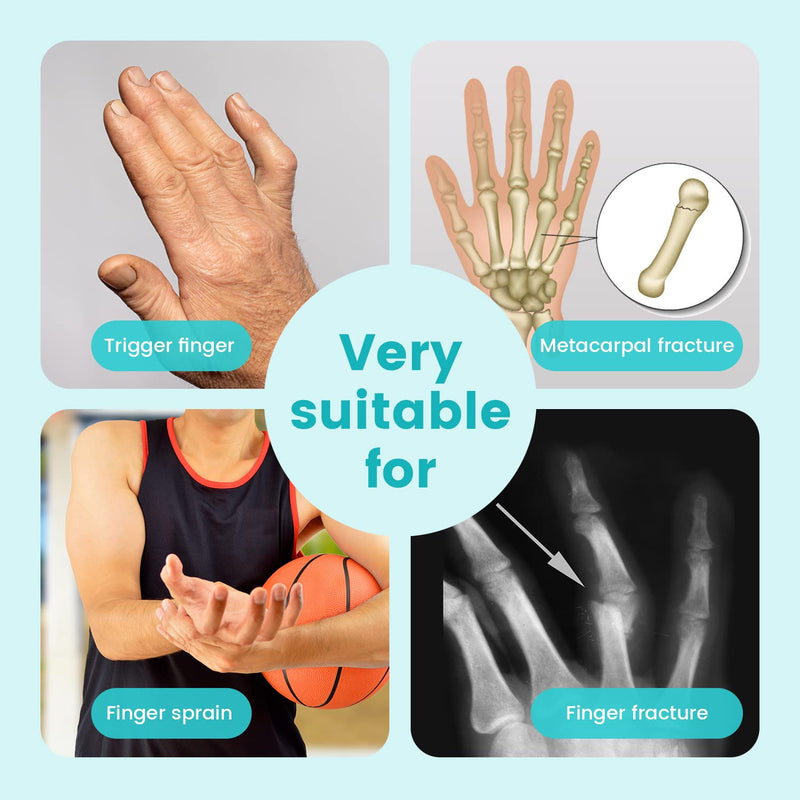 DrFinger Broken Finger Splint Brace for Trigger Finger,Injured, Arthritis Pain, Adjustable Brace with 2 Aluminum Plate (2-Fingers) DFHSZ02