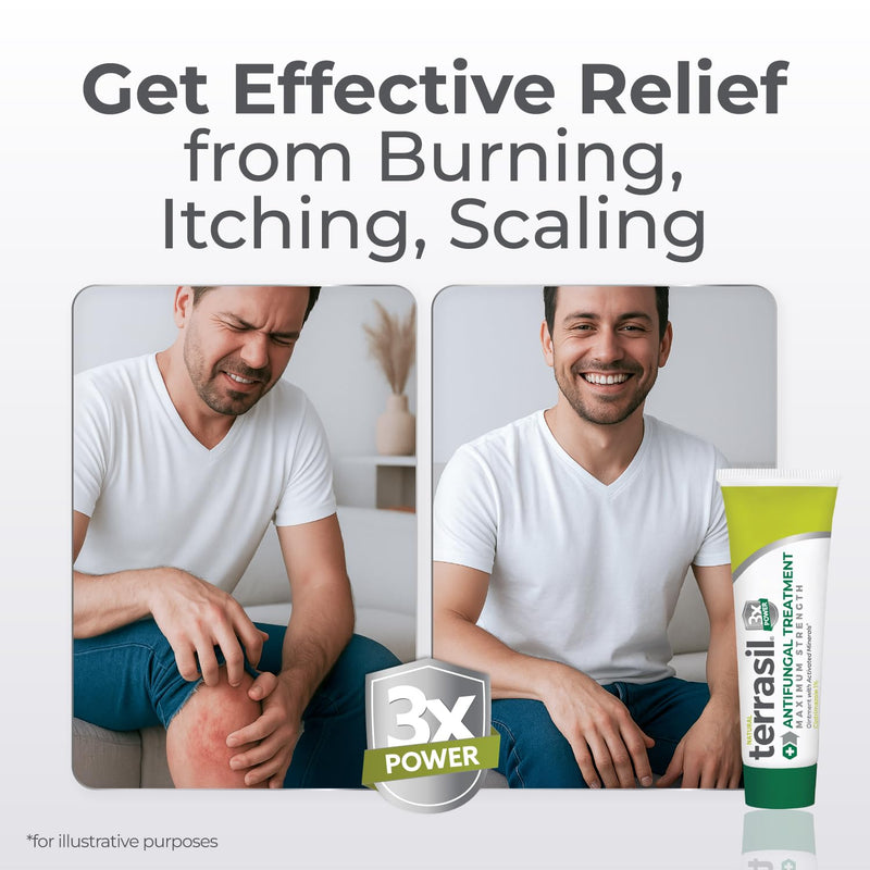 terrasil Clotrimazole Antifungal Cream, Relief for Fungal Yeast Infections, Jock Itch, Athletes Foot, Ringworm for Men & Women, Clinically Proven Treatment of Skin Fungus. FSA-HSA Eligible (1oz) 1 Ounce - BeesActive Australia