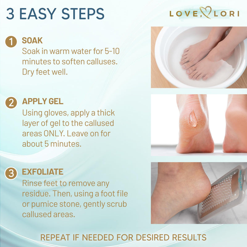 Foot Callus Remover Kit - Foot File & Callus Gel Feet Scrubber Dead Skin Scraper Bundle, 6oz - BeesActive Australia