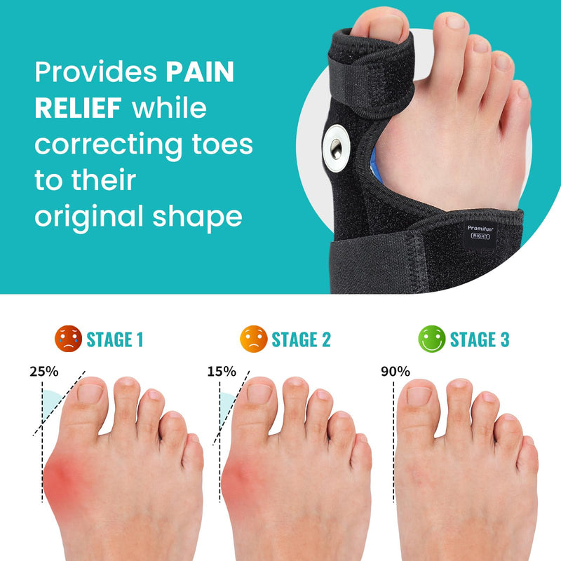 Promifun Bunion Corrector for Women & Men - 1 Pair Adjustable Toe Splint for Broken Toe - Pain Relief Support Brace & Straightener with Non-Slip Strap(Black) Black
