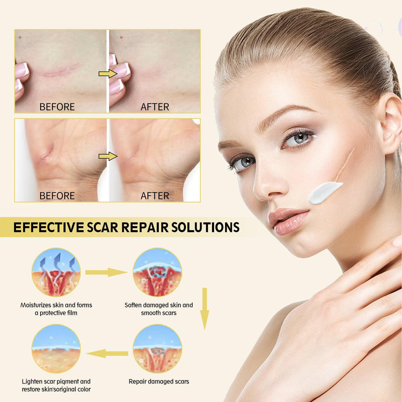Advanced Scar Cream, Silicone Gel for Scars, Professional Scar Removal Cream for Surgical Scars, Stretch Marks, Old and New Scars, Keloids, Acne, Burns, 2 oz(60ml)