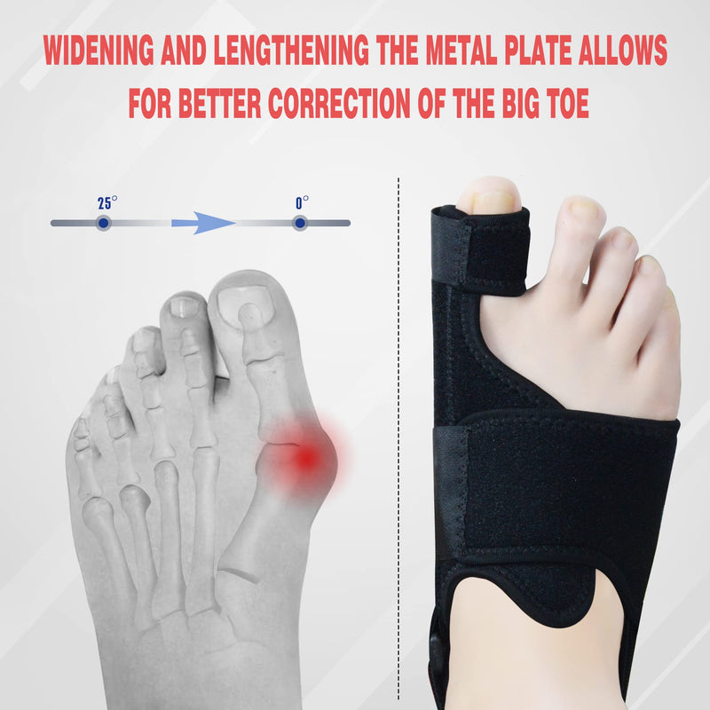 MOONSMILE Foot Gear 1 Pair Bunion Corrector for Women & Men, Night Bunion Splint, Big Toe Straightener, Foot Gear Brace for Bunion Pain Relief Black/Grey One Size