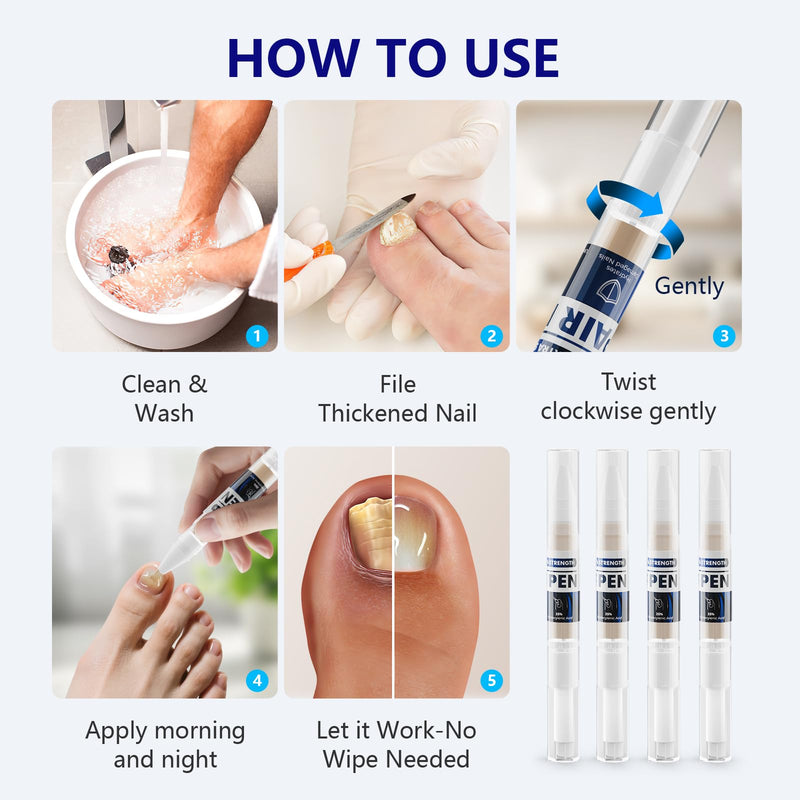 iKeener Toe Nail Fungus Treatment Pen - 25% Undecylenic Acid, Tea Tree Oil Extra Strength for Toenails and Fingernails (0.3 Fl Oz)