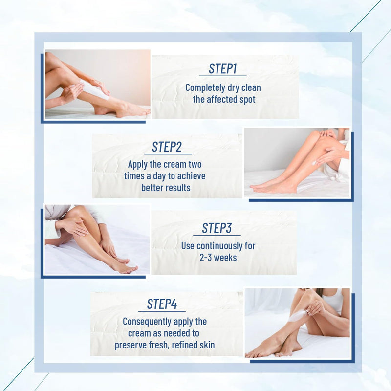 Urea Cream, 40 percent Foot Care Lotion for Cracked Heels,Cracked Heels, Ultra,Rough, Dry, Calloused Feet,Softening Rough skin on feet 5.29 fl.oz for All Skin