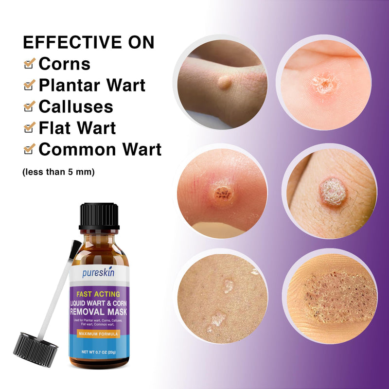 Wart Corn Removal for Feet: Salicylic Acid Plantar Wart Corn Remover Treatment for Toes Foot fingers hands - BeesActive Australia