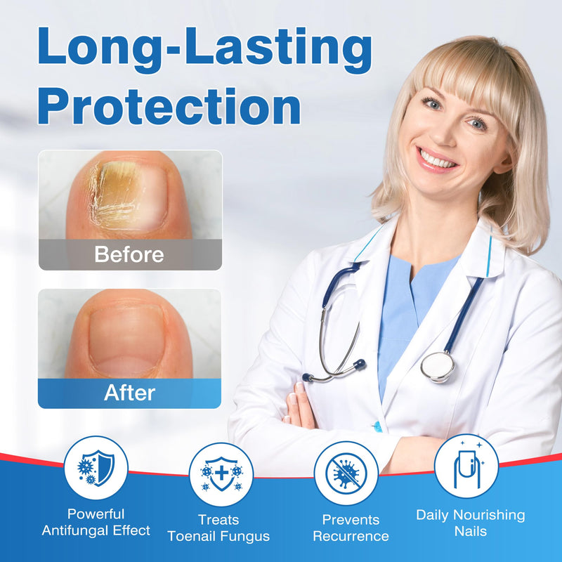Toenail Fungus Treatment Extra Strength - DR.RAPID Toenail Fungus Treatment Pen with 25% Undecylenic Acid & Tolnaftate, Ideal for Fungus Treatment for Damaged Nails & Fingernails 5ml/0.18FLOZ 3Pcs 1 Count (Pack of 3)