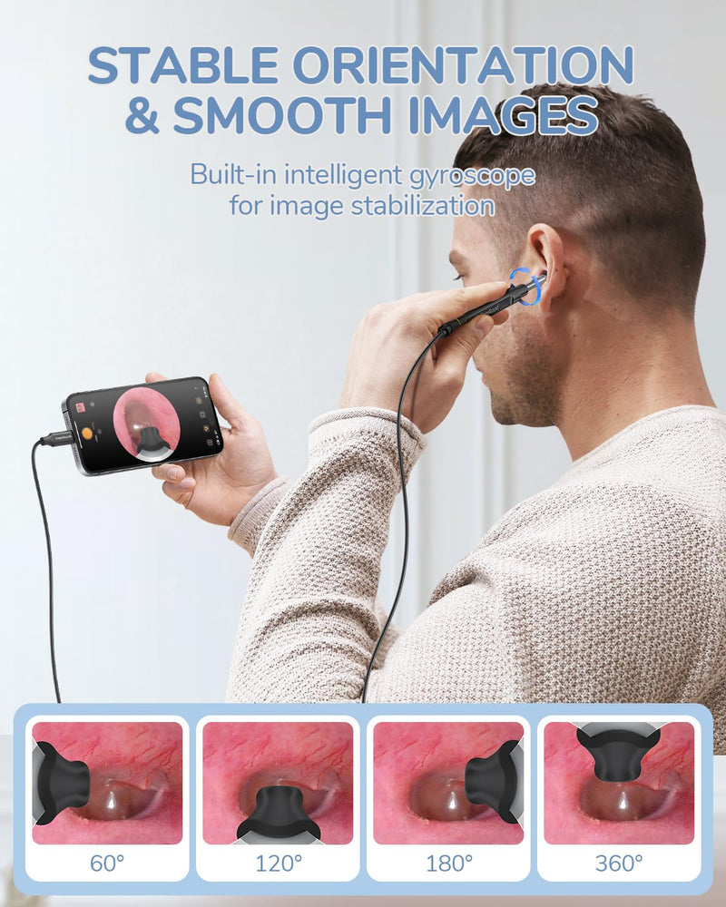 ScopeAround Otoscope with Light, 1080P FHD Ear Scope, 3.9mm Digital Otoscope Camera with 6 LED Lights Ear Wax Removal Tool Camera, Ear Scope with Light, Compatible with USB-C - BeesActive Australia