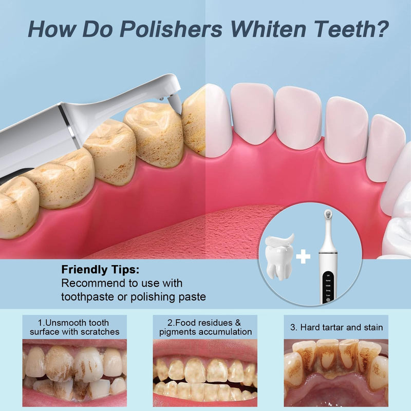 Tooth Polisher,Rechargeable Tooth Whitening Kit for Teeth Cleaning and Whitening, with 8 Brush Heads, LED Light, 5 Speed Modes Dental Polisher Personal Dental Care Kit for Home Use and Travel White