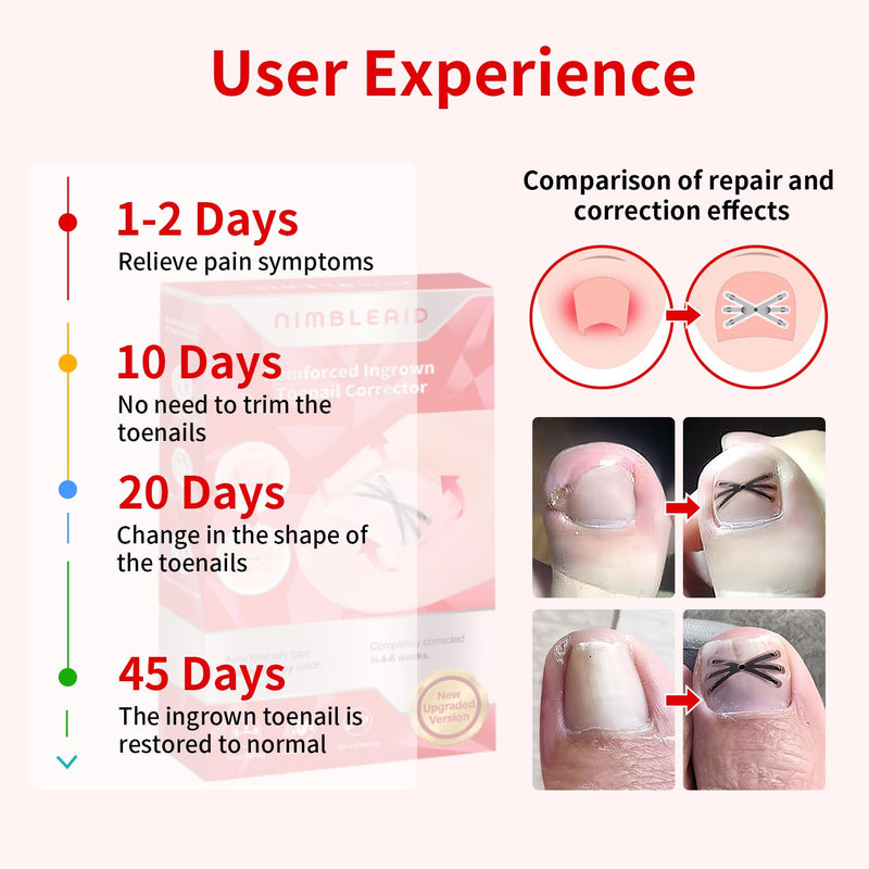 Upgraded Titanium Alloy Ingrown Toenail Corrector with Upgraded 6-Angle Shape,3x Stronger Pull Force,Ingrown Toenail Removal Kit, Ingrown Toenail Treatment for Women and Man (Small size) 1 Count (Pack of 14) - BeesActive Australia