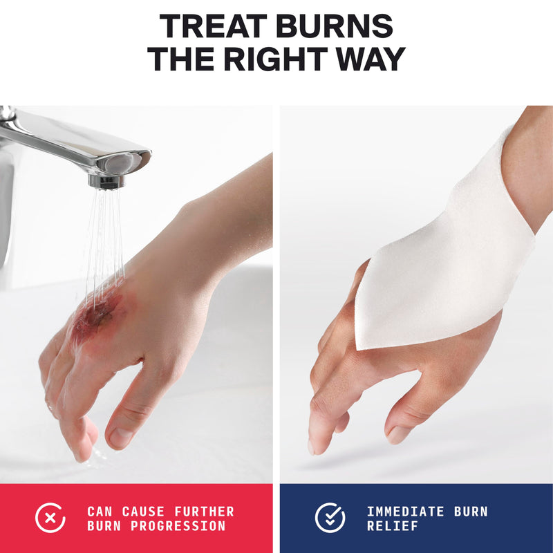 SurviveX Burn Dressing Kit with Tea Tree Oil - Hydrogel Burn Pads, Cooling Gels, Non-Adhesive Dressings & Gauze - Complete First Aid Accessory for Instant Cooling, Soothing & Burn Relief