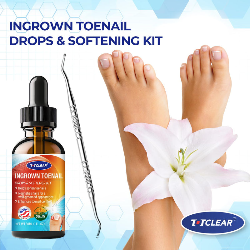 Ingrown Toenail Relief: Ingrown Toenail Tool for Men Women - Ingrown Toenail Removal Kit - Ingrown Toenail Corrector Drops - Ingrown Toenail Removal - Effective Solution for Ingrown Toenails - 30ml 1 Fl Oz (Pack of 1)