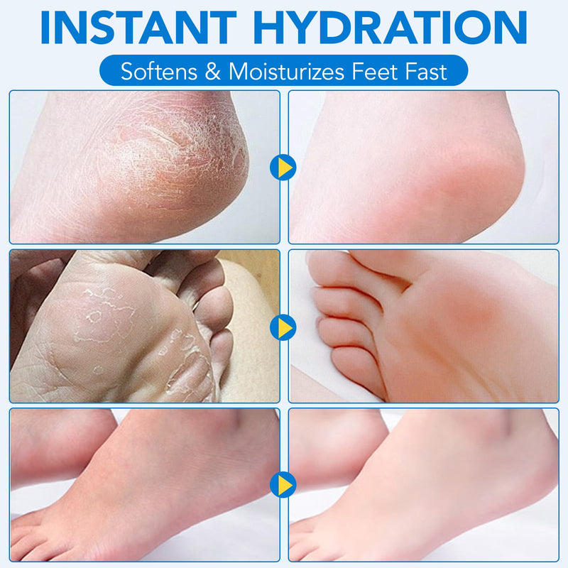 Uruses 3Pack Urea Cream 60% plus Salicylic Acid 2% Urea Foot Care Stick,Foot Cream for Foot Callus Remover, Feet Moisturizer Stick for Dry Cracked Heels, Hands, Knees,Hydrating Heel Balm, Easy To Use - BeesActive Australia