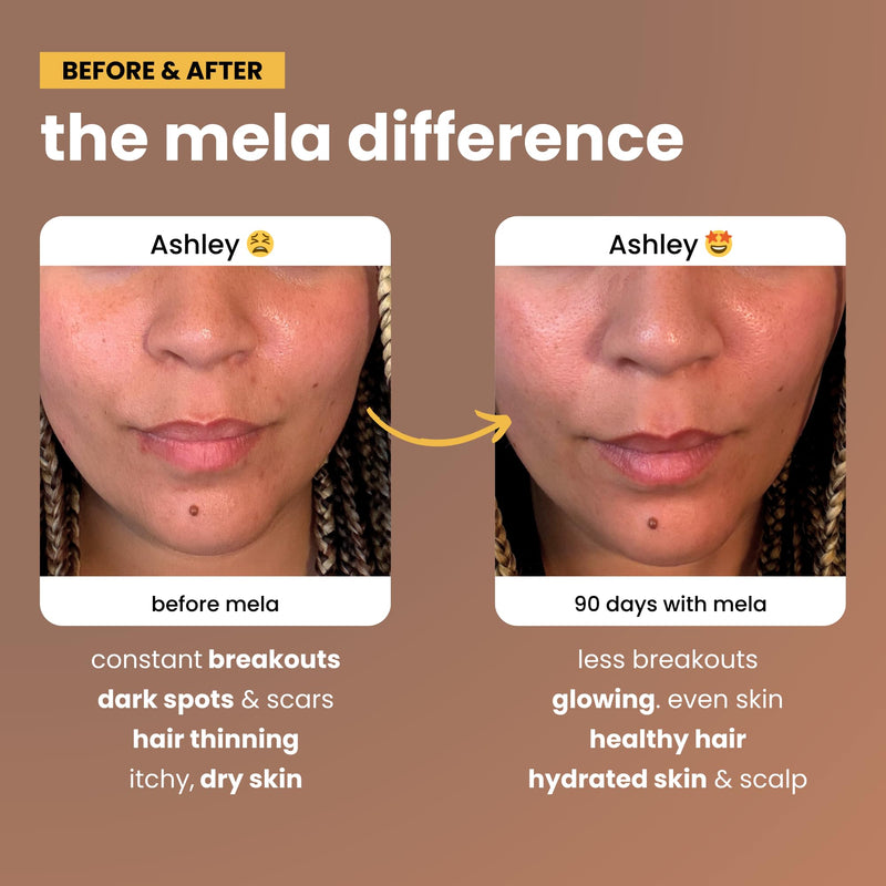 Mela Daily Glow for Healthy Melanin-Rich Skin & Textured Hair – with Silica, Millet, Pumpkin Seed, Probiotics, Hyaluronic Acid & Vitamin D3 – Vegan, Biotin-Free, Gluten & Soy-Free – 60 Count