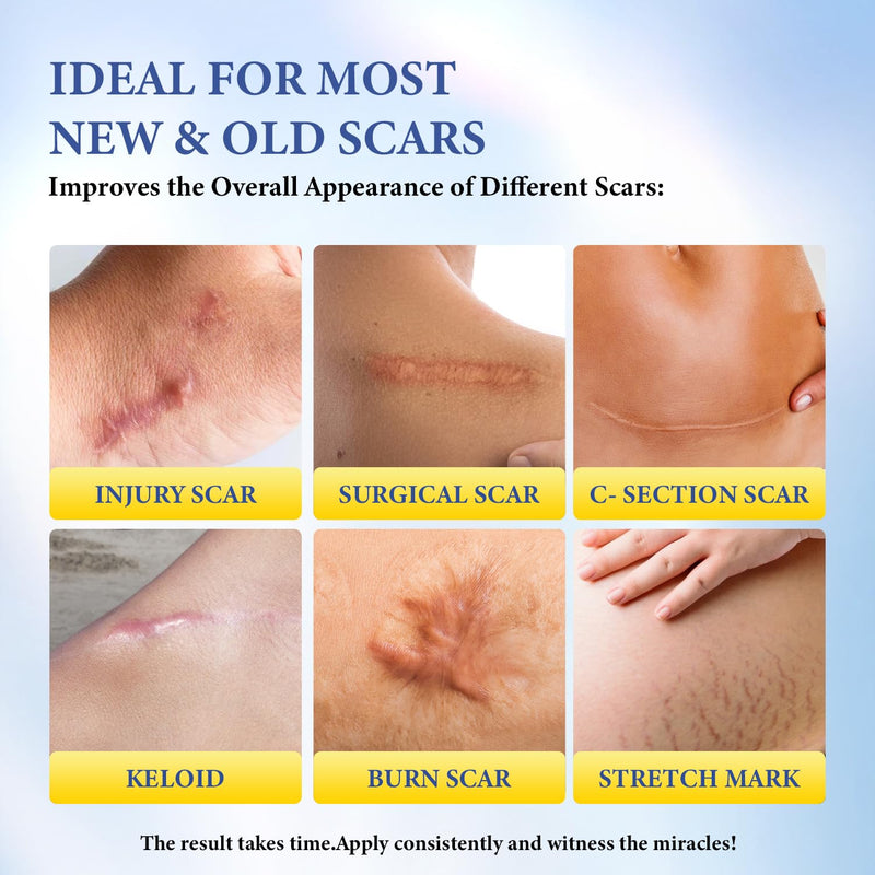 BORMSI Scar Cream,SPF 30 Suncreen & PM Silicone Intensive Overnight Scar Gel Reduces the Appearance of Scars from Surgical Scars,Stretch Marks,Keloid, 2 Tube,1.76 oz/Tube - BeesActive Australia