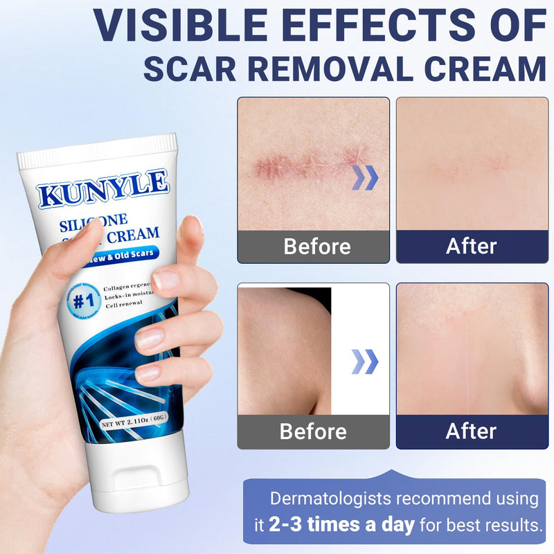 Scar Cream, Silicone Scar Gel, Advanced Scar Removal Cream for Surgical Scars, Stretch Marks Removal, Keloid Bump Removal, Old and New Scars 2.11 Oz (60g) Scar Cream 2.11 Ounce