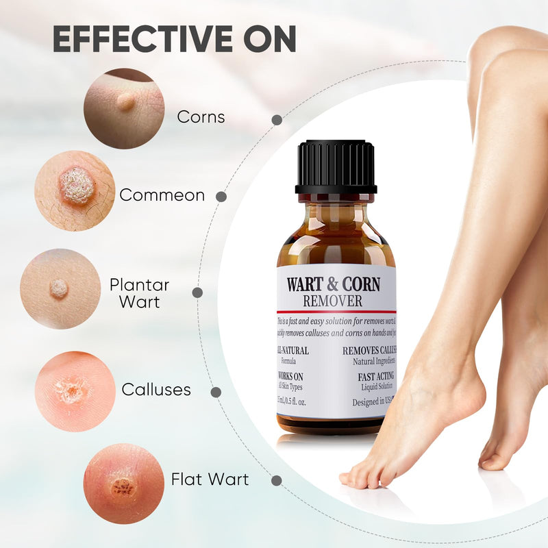 Wart & Corn Remover Liquid, Smoothes Skin Gentle Fast Acting Gel Wart Removal for Plantar Wart Flat Warts and Corns White - BeesActive Australia